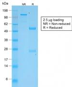 TNFS15/VEGI (Vascular Endothelial Growth Inhibitor) Antibody in SDS-PAGE (SDS-PAGE)