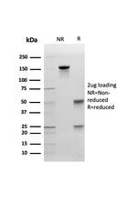 E-Cadherin (CDH1)/CD324 Antibody in SDS-PAGE (SDS-PAGE)