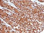 E-Cadherin (CDH1)/CD324 (Intercellular Junction Marker) Antibody in Immunohistochemistry (Paraffin) (IHC (P))