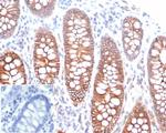 E-Cadherin (CDH1)/CD324 (Intercellular Junction Marker) Antibody in Immunohistochemistry (Paraffin) (IHC (P))