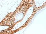 E-Cadherin (CDH1)/CD324 (Intercellular Junction Marker) Antibody in Immunohistochemistry (Paraffin) (IHC (P))