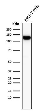 E-Cadherin (CDH1)/CD324 (Intercellular Junction Marker) Antibody in Western Blot (WB)