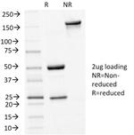 E-Cadherin (CDH1)/CD324 (Intercellular Junction Marker) Antibody in SDS-PAGE (SDS-PAGE)