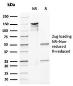 E-Cadherin (CDH1)/CD324 Antibody in SDS-PAGE (SDS-PAGE)