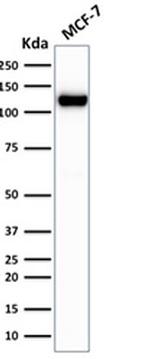 E-Cadherin (CDH1)/CD324 Antibody in Western Blot (WB)