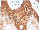 E-Cadherin (CDH1)/CD324 Antibody in Immunohistochemistry (Paraffin) (IHC (P))