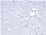 E-Cadherin (CDH1)/CD324 Antibody in Immunohistochemistry (Paraffin) (IHC (P))