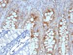 E-Cadherin (CDH1)/CD324 (Intercellular Junction Marker) Antibody in Immunohistochemistry (Paraffin) (IHC (P))