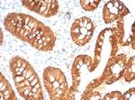 E-Cadherin (CDH1)/CD324 (Intercellular Junction Marker) Antibody in Immunohistochemistry (Paraffin) (IHC (P))