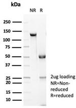 E-Cadherin (CDH1)/CD324 (Intercellular Junction Marker) Antibody in SDS-PAGE (SDS-PAGE)