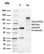 E-Cadherin (CDH1)/CD324 Antibody in SDS-PAGE (SDS-PAGE)