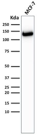 E-Cadherin (CDH1)/CD324 Antibody in Western Blot (WB)