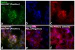 Mouse IgG (H+L) Cross-Adsorbed Secondary Antibody in Immunocytochemistry (ICC/IF)