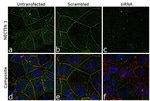 Goat IgG (H+L) Cross-Adsorbed Secondary Antibody in Immunocytochemistry (ICC/IF)