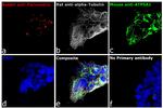 Rat IgG (H+L) Cross-Adsorbed Secondary Antibody in Immunocytochemistry (ICC/IF)