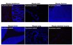 Rabbit IgG (H+L) Secondary Antibody in Immunohistochemistry (Paraffin) (IHC (P))