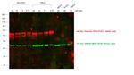 Rabbit IgG (H+L) Cross-Adsorbed Secondary Antibody in Western Blot (WB)