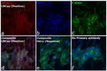 Goat IgG (H+L) Cross-Adsorbed Secondary Antibody in Immunocytochemistry (ICC/IF)