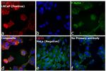 Mouse IgG2b Cross-Adsorbed Secondary Antibody in Immunocytochemistry (ICC/IF)