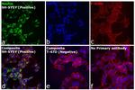 Mouse IgG (H+L) Cross-Adsorbed Secondary Antibody in Immunocytochemistry (ICC/IF)