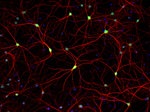 Mouse IgG (H+L) Highly Cross-Adsorbed Secondary Antibody in Immunocytochemistry (ICC/IF)