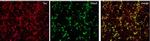 Mouse IgG (H+L) Highly Cross-Adsorbed Secondary Antibody in Immunocytochemistry (ICC/IF)