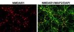 Rabbit IgG (H+L) Highly Cross-Adsorbed Secondary Antibody in Immunocytochemistry (ICC/IF)