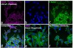 Mouse IgG2b Cross-Adsorbed Secondary Antibody in Immunocytochemistry (ICC/IF)