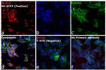 Mouse IgG (H+L) Cross-Adsorbed Secondary Antibody in Immunocytochemistry (ICC/IF)