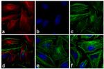 Mouse IgG (H+L) Highly Cross-Adsorbed Secondary Antibody in Immunocytochemistry (ICC/IF)