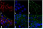 Rabbit IgG (H+L) Secondary Antibody in Immunocytochemistry (ICC/IF)