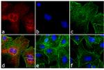 Rat IgG (H+L) Cross-Adsorbed Secondary Antibody in Immunocytochemistry (ICC/IF)