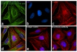 Mouse IgG (H+L) Cross-Adsorbed Secondary Antibody in Immunocytochemistry (ICC/IF)