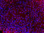 Mouse IgG (H+L) Cross-Adsorbed Secondary Antibody in Immunocytochemistry (ICC/IF)