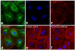 Rat IgG (H+L) Cross-Adsorbed Secondary Antibody in Immunocytochemistry (ICC/IF)