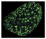 Rabbit IgG (H+L) Cross-Adsorbed Secondary Antibody in Immunohistochemistry (IHC)