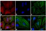 Mouse IgG (H+L) Cross-Adsorbed Secondary Antibody in Immunocytochemistry (ICC/IF)