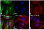 Mouse IgG (H+L) Highly Cross-Adsorbed Secondary Antibody in Immunocytochemistry (ICC/IF)