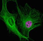 Mouse IgG (H+L) Highly Cross-Adsorbed Secondary Antibody in Immunocytochemistry (ICC/IF)