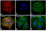 Mouse IgG (H+L) Highly Cross-Adsorbed Secondary Antibody in Immunocytochemistry (ICC/IF)