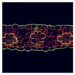 Rabbit IgG (H+L) Highly Cross-Adsorbed Secondary Antibody in Immunocytochemistry (ICC/IF)