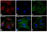 Rabbit IgG (H+L) Highly Cross-Adsorbed Secondary Antibody in Immunocytochemistry (ICC/IF)