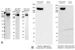 Myc Tag Antibody in Western Blot (WB)