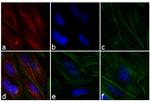 Mouse IgG (H+L) Highly Cross-Adsorbed Secondary Antibody in Immunocytochemistry (ICC/IF)