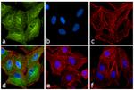 Rat IgG (H+L) Secondary Antibody in Immunocytochemistry (ICC/IF)