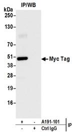 Myc Tag Antibody in Immunoprecipitation (IP)