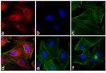 Rat IgG (H+L) Cross-Adsorbed Secondary Antibody in Immunocytochemistry (ICC/IF)