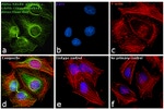 Mouse IgG1 Cross-Adsorbed Secondary Antibody in Immunocytochemistry (ICC/IF)