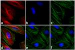 Mouse IgG1 Cross-Adsorbed Secondary Antibody in Immunocytochemistry (ICC/IF)