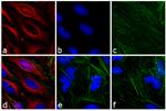 Mouse IgG (H+L) Highly Cross-Adsorbed Secondary Antibody in Immunocytochemistry (ICC/IF)